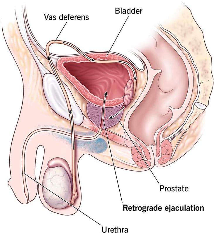 Scientific illustration of semen retention showing male reproductive system